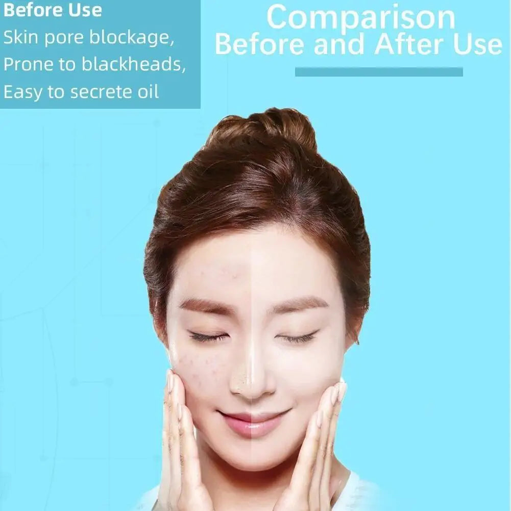 Facial Blackhead Remover 3 Suction Modes Vacuum Pore Face Cleansing Beauty Machine USB Rechargeable Nose Acne Extractor Tool