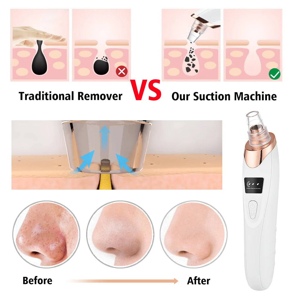 Blackhead Remover Pore Acne Pimple Removal Face T Zone Nose Cleaner Vacuum Suction Facial Diamond Beauty Clean Skin Oil Dirty
