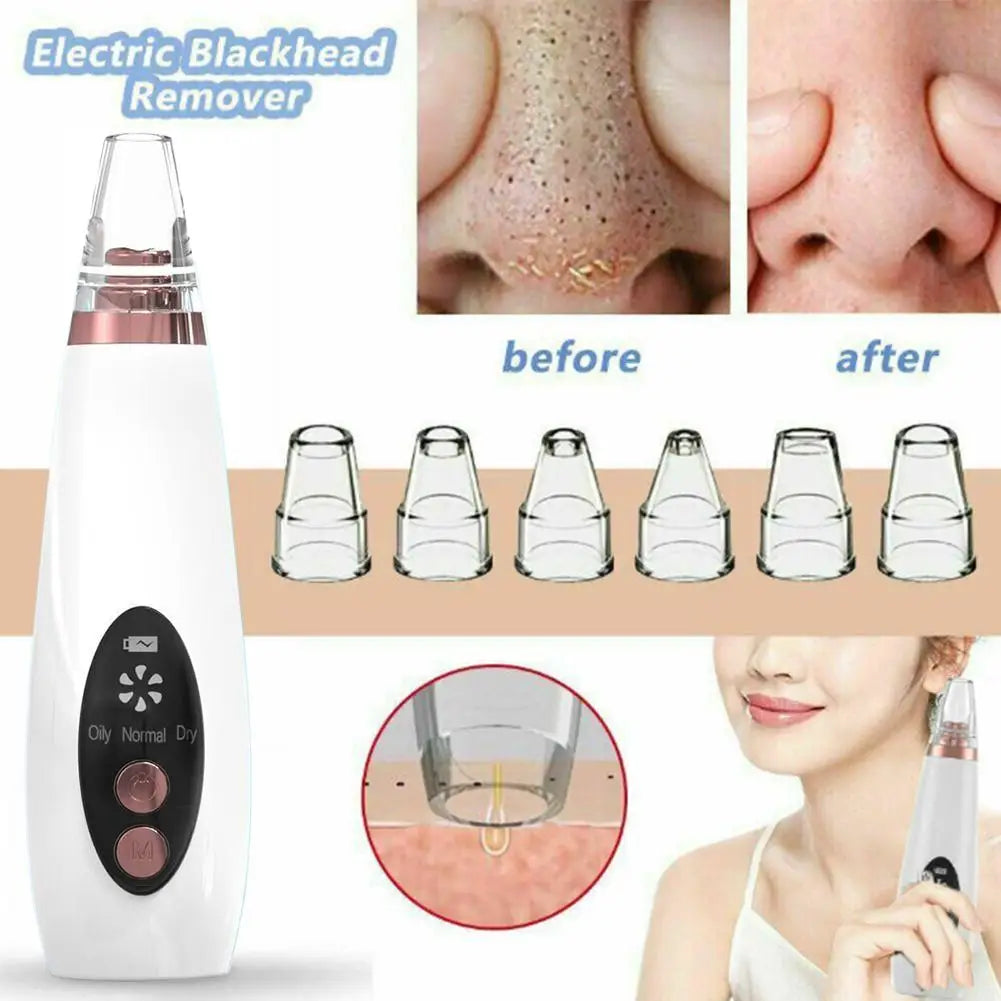 Facial Blackhead Remover 3 Suction Modes Vacuum Pore Face Cleansing Beauty Machine USB Rechargeable Nose Acne Extractor Tool